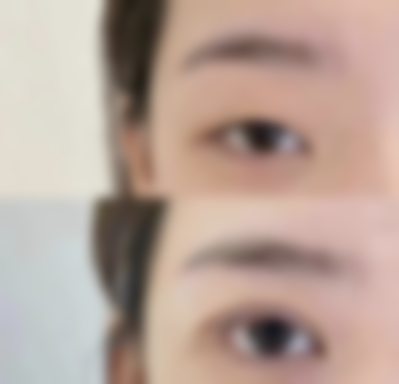 广州积美医疗美容门诊部李灵医生挂号预约攻略