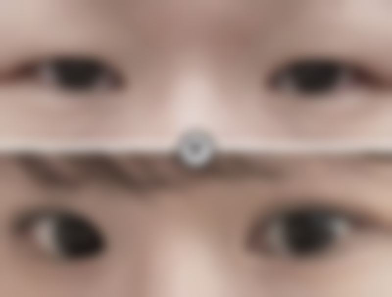 山东烟台华韩整形口碑如何？