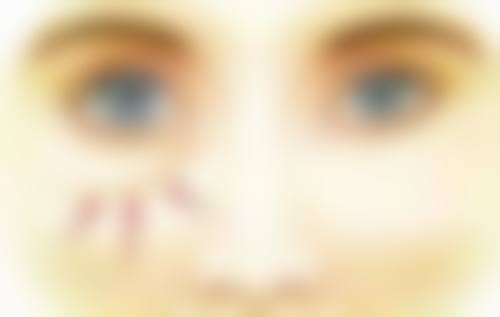 腰腹环吸脂手术安心吗？总结来说