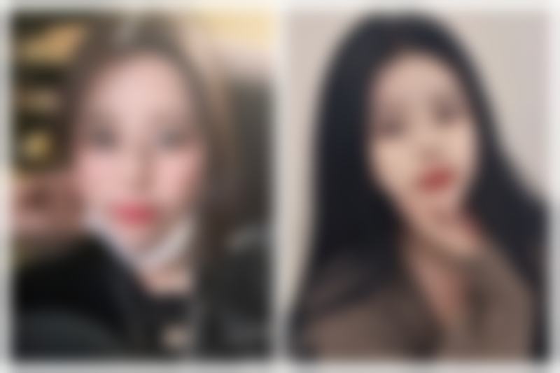 合肥西美整形口碑如何？