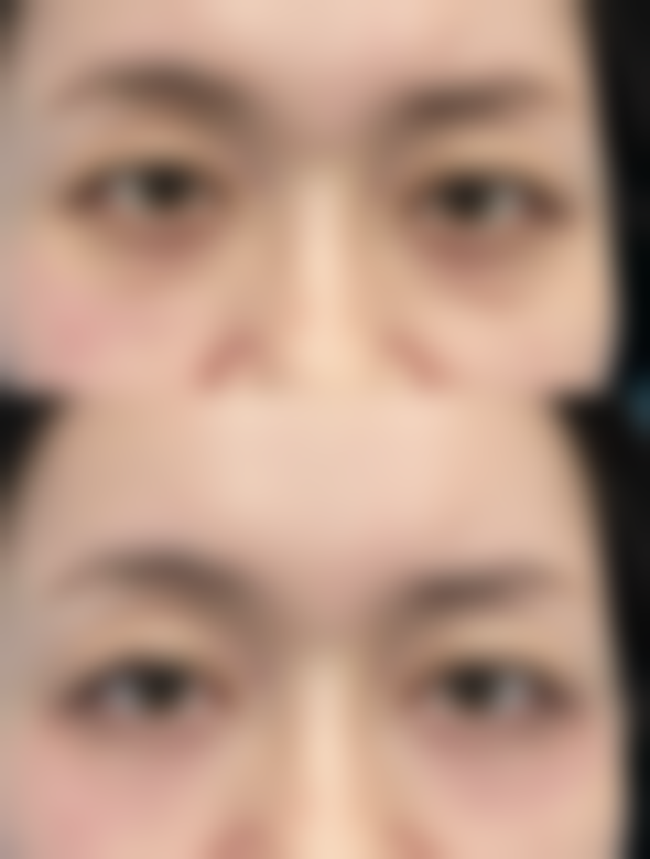 热门去眼袋眼霜推荐