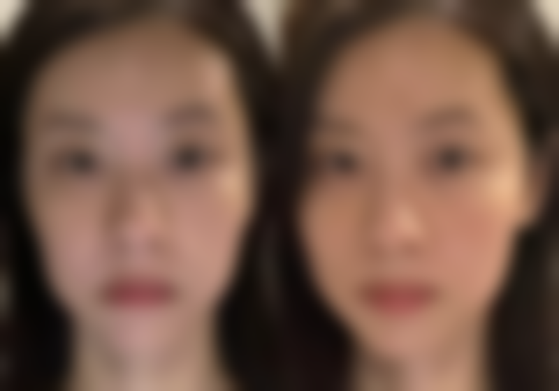 不适合冰敷的情况