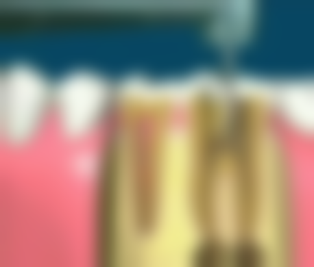 四、重庆黔江区邓兴洪口腔开展的项目以及特色项目