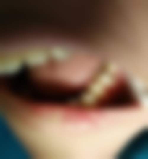 无锡雅善口腔门诊部怎么样