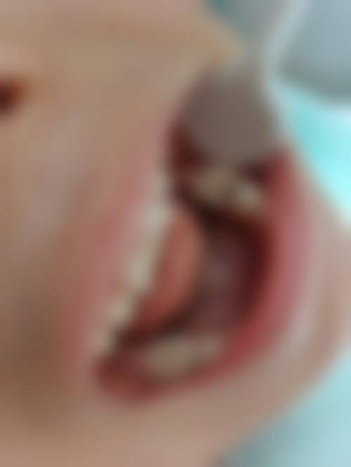 南充梁牙口腔诊所价格表