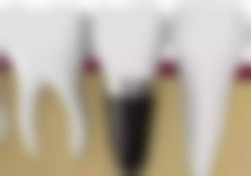 南充梁牙口腔诊所怎么挂号