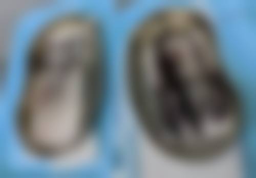 郑州汴美整形收费标准参考