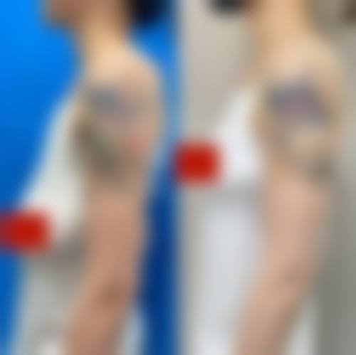 八、太原华美整形医院用户真实实例