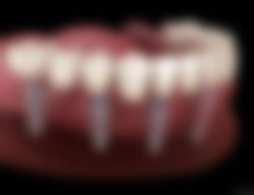 六、广州博康口腔门诊部怎么预约：