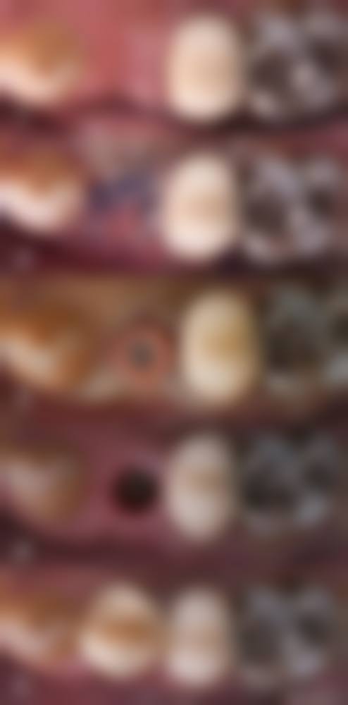 七、广州博康口腔门诊部价格表：（仅供参考）