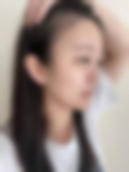 六、太原华美整形医院怎么预约：