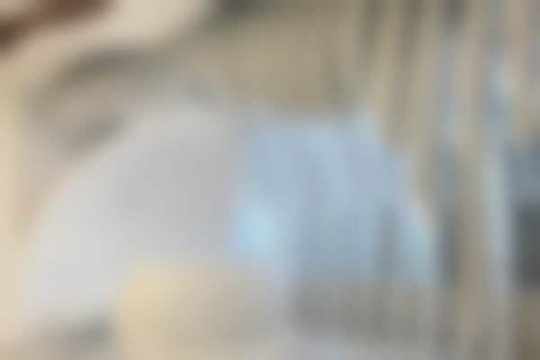 乌鲁木齐福宏林口腔门诊儿童早期矫正效果如何？专业服务见证成效