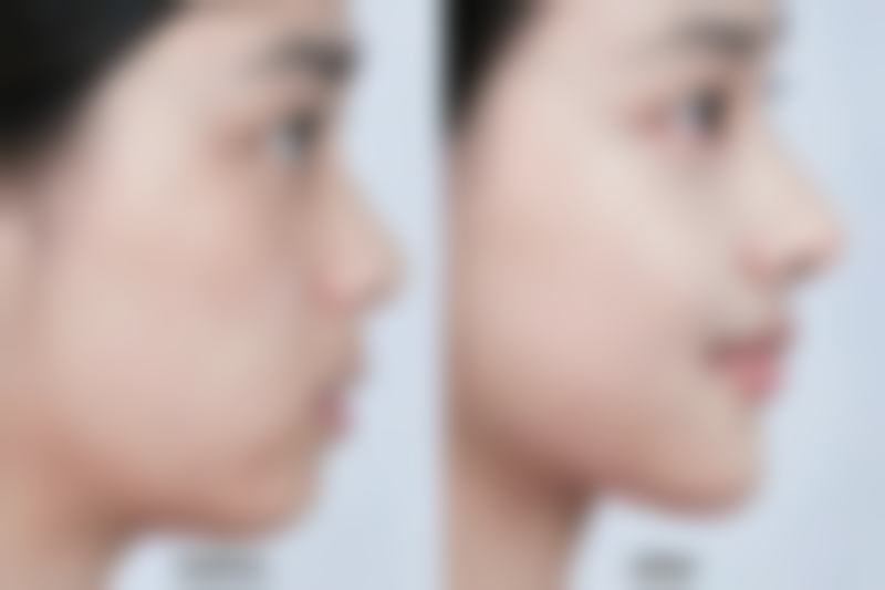 总结——深圳新生医疗美容门诊部怎么样？