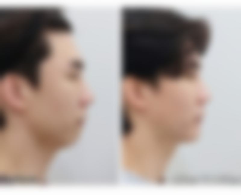 石家庄巍名仕医疗美容医院闵度源医生挂号预约攻略