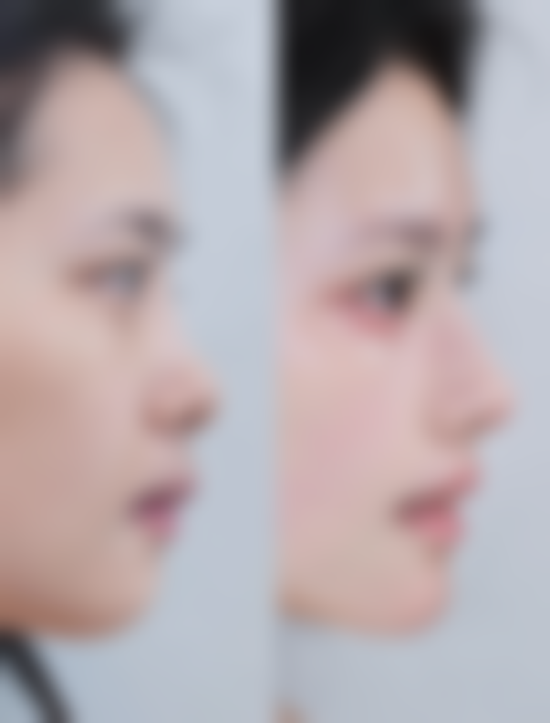 石家庄巍名仕医疗美容医院闵度源医生口碑评价如何？