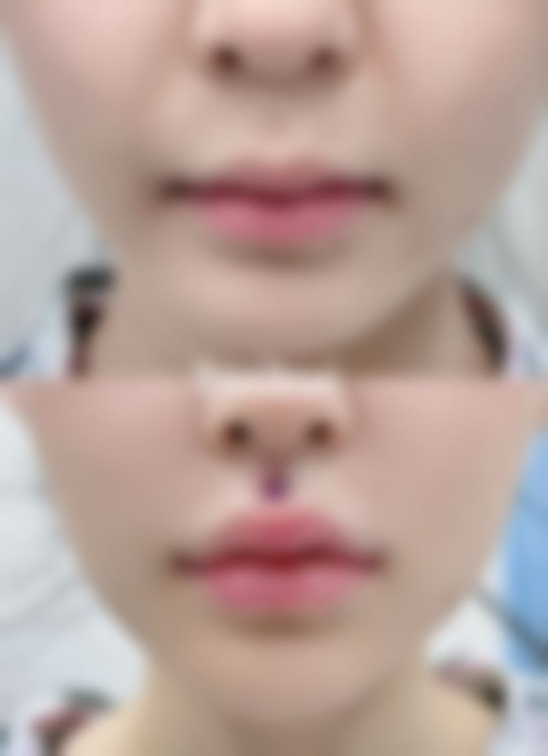 梦想整形外科收费标准参考