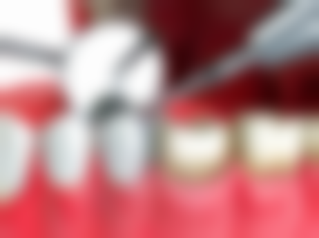 三、广州博康口腔门诊部医生介绍: