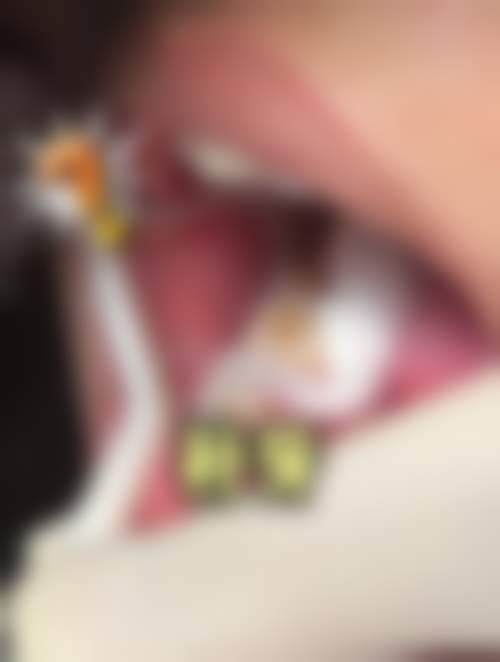 南充梁牙口腔诊所评价