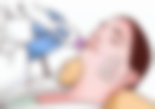 不同年龄段适合的去眼袋方式