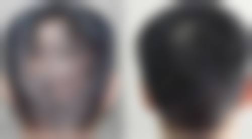 四、武汉市中医和西医结合医院(整形外科)开展的项目以及特色项目