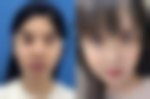 十堰市太和医院整形美容科收费标准参考