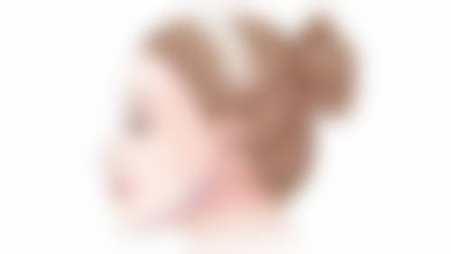 非手术消除遗传眼袋的方法