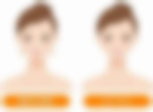 韩国ipche整形外科医院口碑如何？