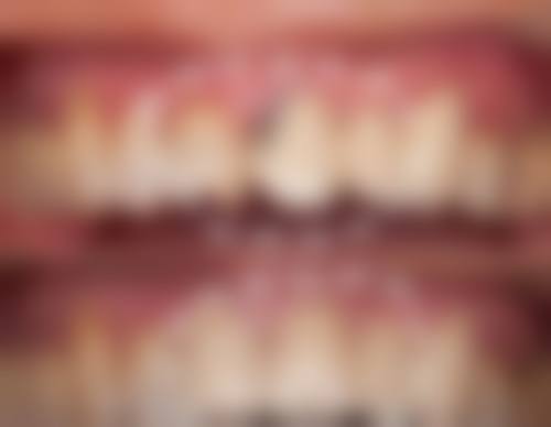 八、谭海莲医生口腔费用一览表