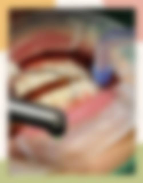 七、河北石家庄栾城郝小利口腔诊所价格表：（仅供参考）