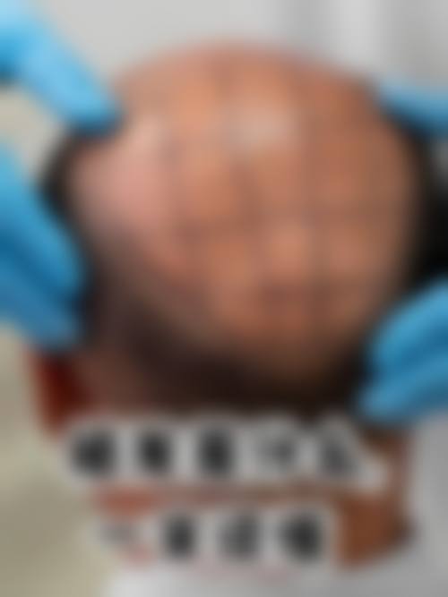 七、武汉市中医和西医结合医院(整形外科)价格表：（仅供参考）