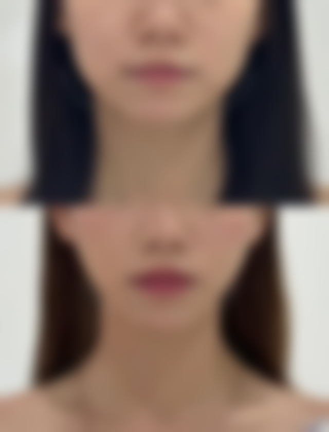 佛山伊万卡医疗美容门诊部电话号码及预约方法