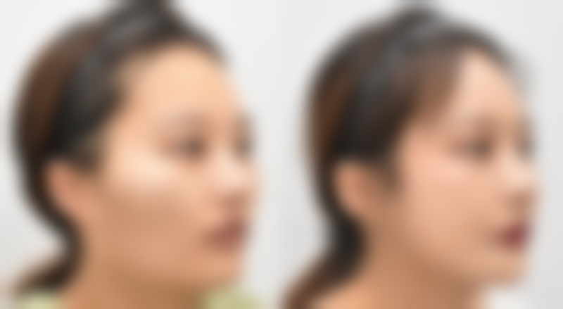 韩国ipche整形外科医院硬件设备精良！