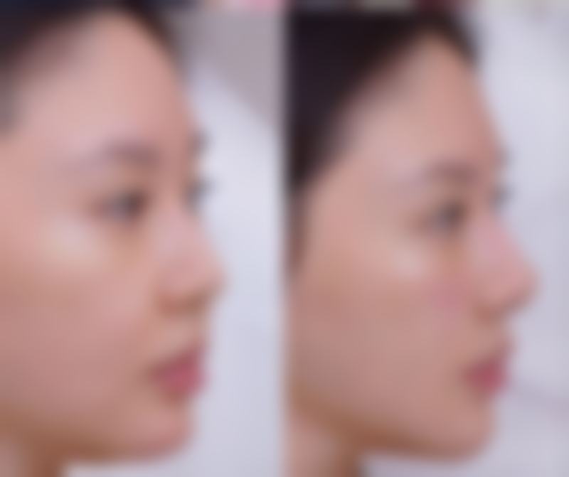 厦门174医院整形美容科医院技术好不好？