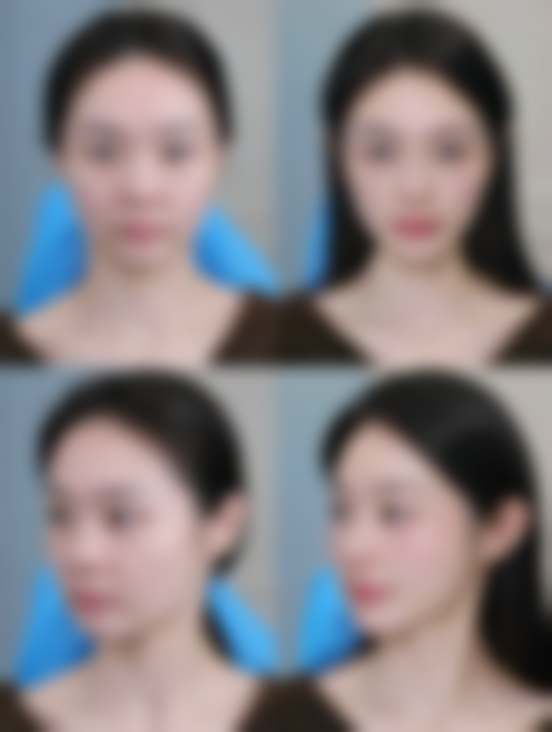 山东省立医院烧伤整形科王德昌医生技术好不好？