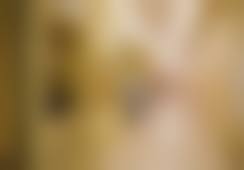 北京英煌医美项力源医生腰腹吸脂技术好不好？