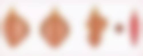 周口新东方医院医疗美容科口碑如何？