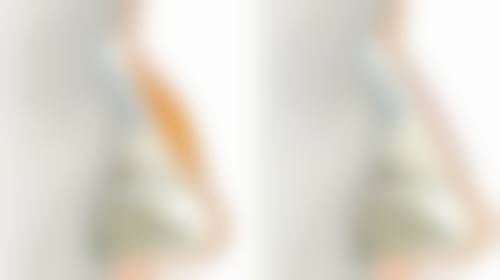 不同体质的人夏天开双眼皮修复情况有差异吗