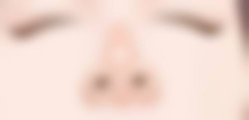 经常熬夜长眼袋了，手术治疗后如何护理