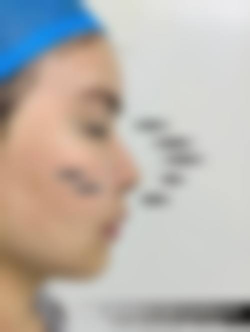 四、随州艾琳整形医院开展的项目以及特色项目