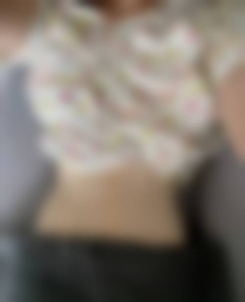 六、随州艾琳整形医院怎么预约：