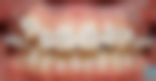 四、淄博临淄齐贝口腔门诊部开展的项目以及特色项目