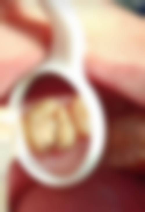 七、淄博临淄齐贝口腔门诊部价格表：（仅供参考）