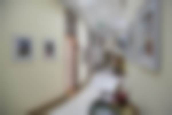 辽宁杏林整形外科医院杜继凤切开双眼皮术后一周线条流畅无隐形消费