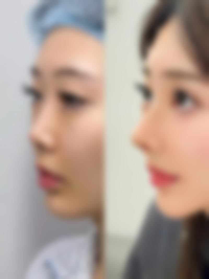 深圳美瑞尔医疗美容门诊部医院技术好不好？