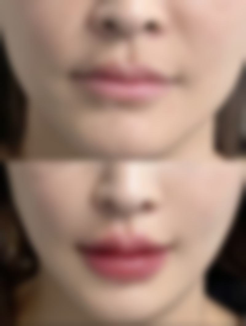 宜昌楚美人医疗美容整形医院电话号码及预约方法