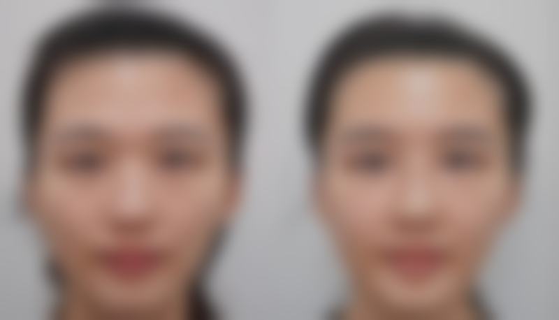 郑州智美海棠医疗收费标准参考