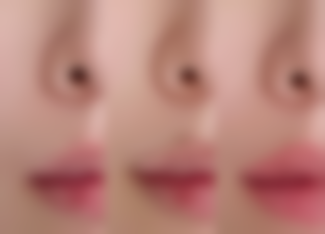 海口龙华代金荣整形医院医院技术好不好？