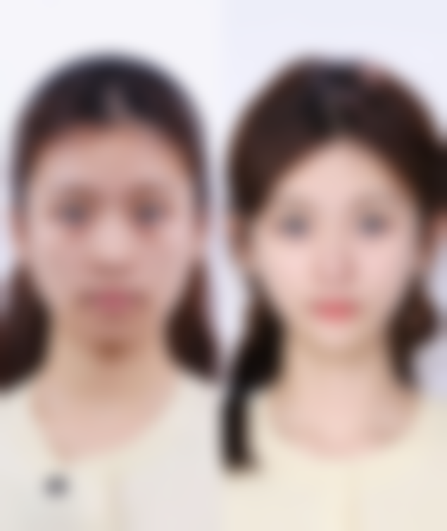 潍坊市人民医院美容整形科收费标准参考