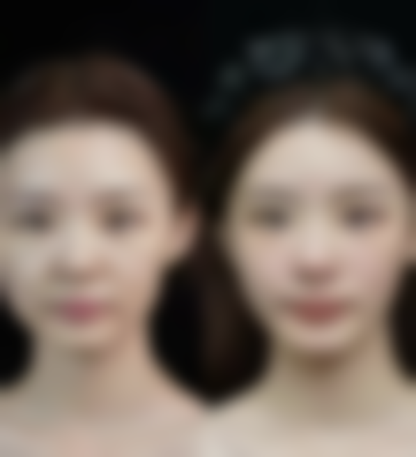 总结——北京华美宝丽诊所怎么样？