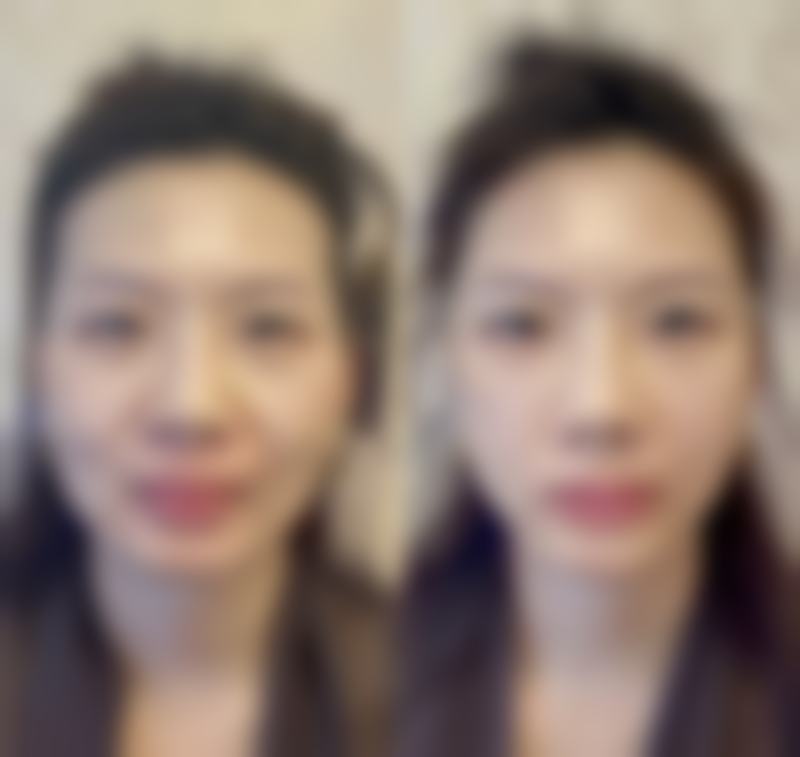 传统面相学里割双眼皮对风水的看法